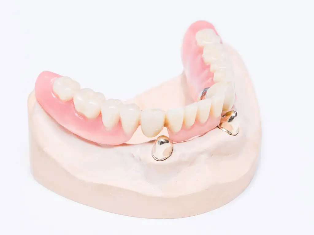 Teilprothese für den Unterkiefer